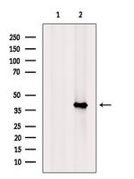 RSPO3 Antibody in Western Blot (WB)