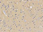 SCO2 Antibody in Immunohistochemistry (Paraffin) (IHC (P))