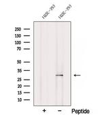 SCO2 Antibody in Western Blot (WB)