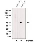 SGMS1 Antibody in Western Blot (WB)