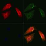 SAB Antibody in Immunocytochemistry (ICC/IF)