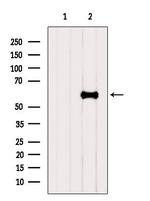 SLC38A1 Antibody in Western Blot (WB)