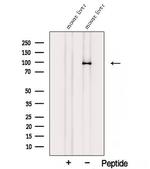 STRA6 Antibody in Western Blot (WB)