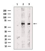 TBCE Antibody in Western Blot (WB)