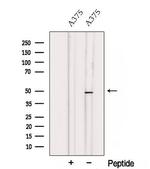 TCN2 Antibody in Western Blot (WB)