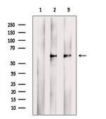 TCN2 Antibody in Western Blot (WB)