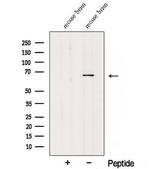 TDRKH Antibody in Western Blot (WB)