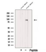 TGM1 Antibody in Western Blot (WB)