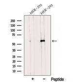 TMEM175 Antibody in Western Blot (WB)