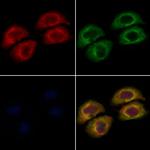 VPS41 Antibody in Immunocytochemistry (ICC/IF)