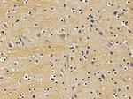 XPO6 Antibody in Immunohistochemistry (Paraffin) (IHC (P))