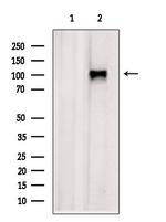 XPO6 Antibody in Western Blot (WB)