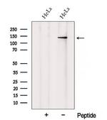 XPO6 Antibody in Western Blot (WB)