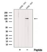 ZHX1 Antibody in Western Blot (WB)