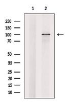 ZHX1 Antibody in Western Blot (WB)