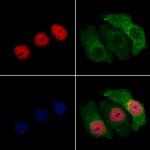 ZNF238 Antibody in Immunocytochemistry (ICC/IF)