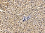 SOAT2 Antibody in Immunohistochemistry (Paraffin) (IHC (P))