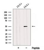 Adiponectin Receptor 2 Antibody in Western Blot (WB)