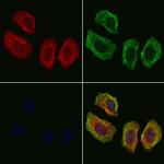 AFAP Antibody in Immunocytochemistry (ICC/IF)