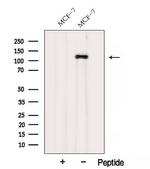 AFAP Antibody in Western Blot (WB)