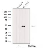 AIPL1 Antibody in Western Blot (WB)