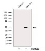 ARP2 Antibody in Western Blot (WB)