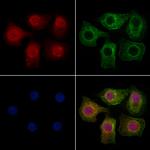 BRD2 Antibody in Immunocytochemistry (ICC/IF)