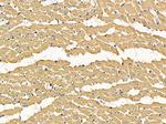 C13orf18 Antibody in Immunohistochemistry (Paraffin) (IHC (P))