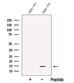 C1orf31 Antibody in Western Blot (WB)