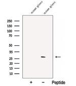 C1orf77 Antibody in Western Blot (WB)