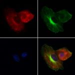 Cathepsin L Antibody in Immunocytochemistry (ICC/IF)