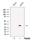 Cathepsin L Antibody in Western Blot (WB)