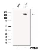 CC2D2A Antibody in Western Blot (WB)