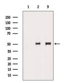 TCP-1 delta Antibody in Western Blot (WB)