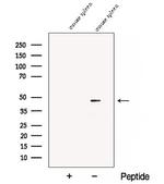 CD84 Antibody in Western Blot (WB)