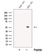 CHMP7 Antibody in Western Blot (WB)