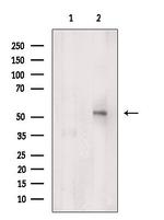 CHMP7 Antibody in Western Blot (WB)