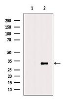 SARNP Antibody in Western Blot (WB)