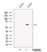 DPYSL3 Antibody in Western Blot (WB)