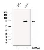 DCP1B Antibody in Western Blot (WB)