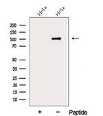 DDX10 Antibody in Western Blot (WB)