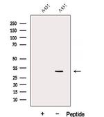 DENR Antibody in Western Blot (WB)