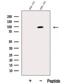 DHX15 Antibody in Western Blot (WB)