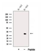 DLEU1 Antibody in Western Blot (WB)