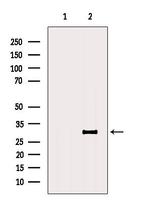 DLEU1 Antibody in Western Blot (WB)