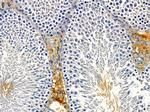 EHBP1 Antibody in Immunohistochemistry (Paraffin) (IHC (P))