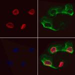 EPCR Antibody in Immunocytochemistry (ICC/IF)