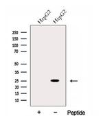 EVI2A Antibody in Western Blot (WB)