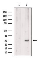 EVI2A Antibody in Western Blot (WB)