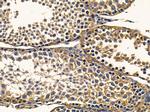 EXPH5 Antibody in Immunohistochemistry (Paraffin) (IHC (P))